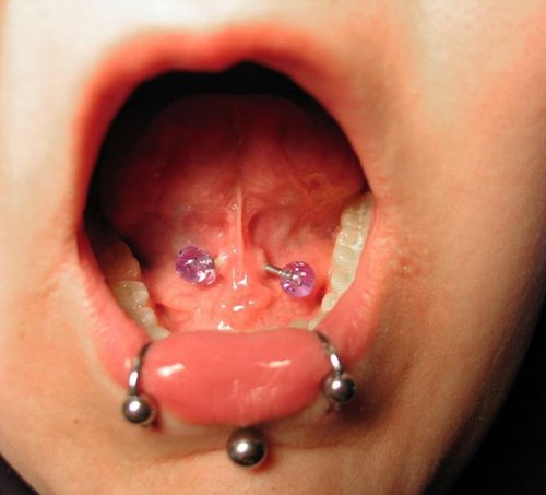 Os piercings em regiões de tecidos moles, como a língua e os lábios, 